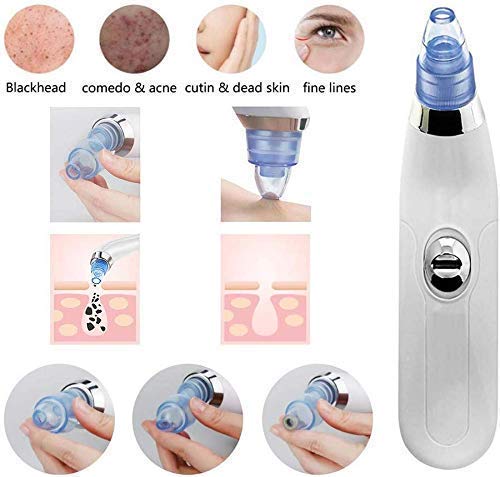 Derma Suction 3 in 1 Blackhead Removal Machine