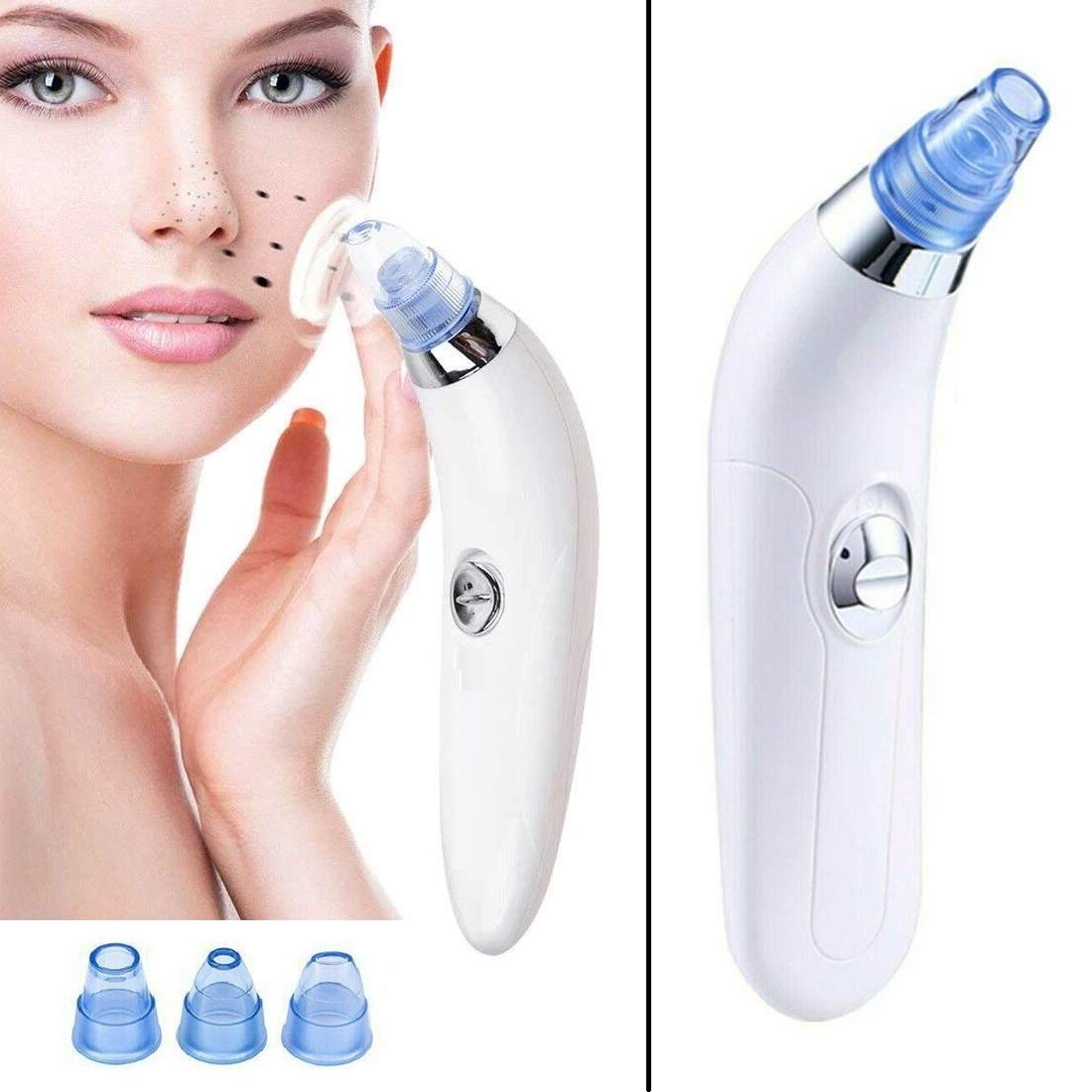 Derma Suction 3 in 1 Blackhead Removal Machine